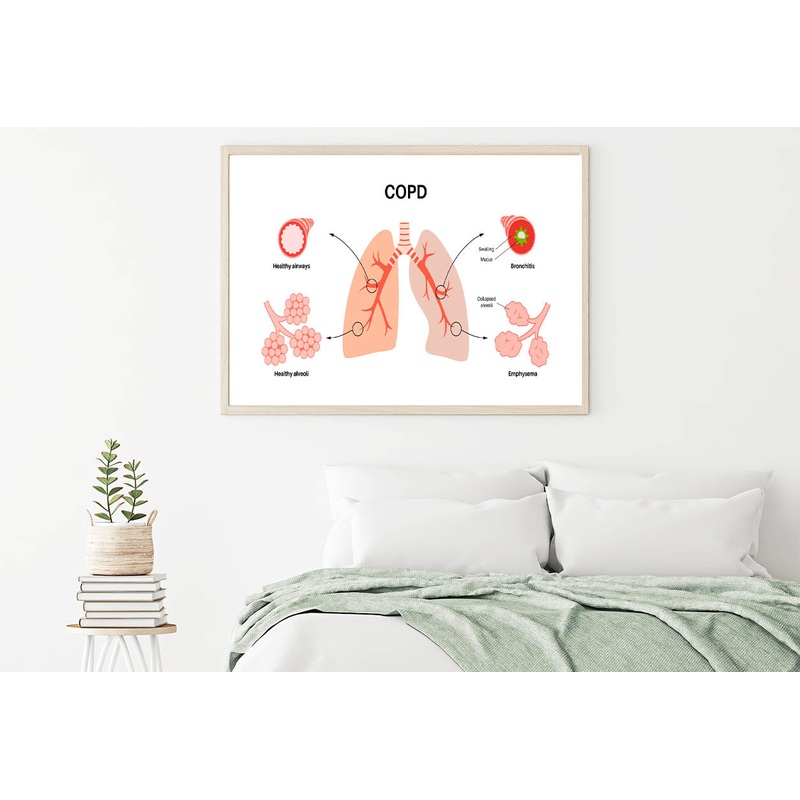 Chronic Obstructive Pulmonary Disease Home Decor Premium Quality Poster Print Choose Your Sizes
