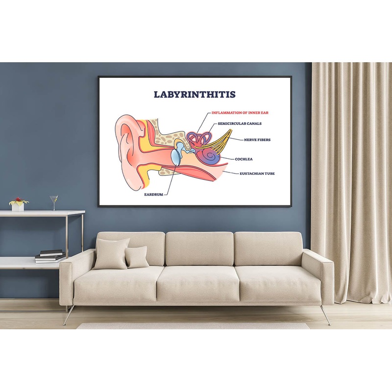 Labyrinthitis As Inner Ear Infection Diagram Home Decor Premium Quality Poster Print Choose Your Sizes