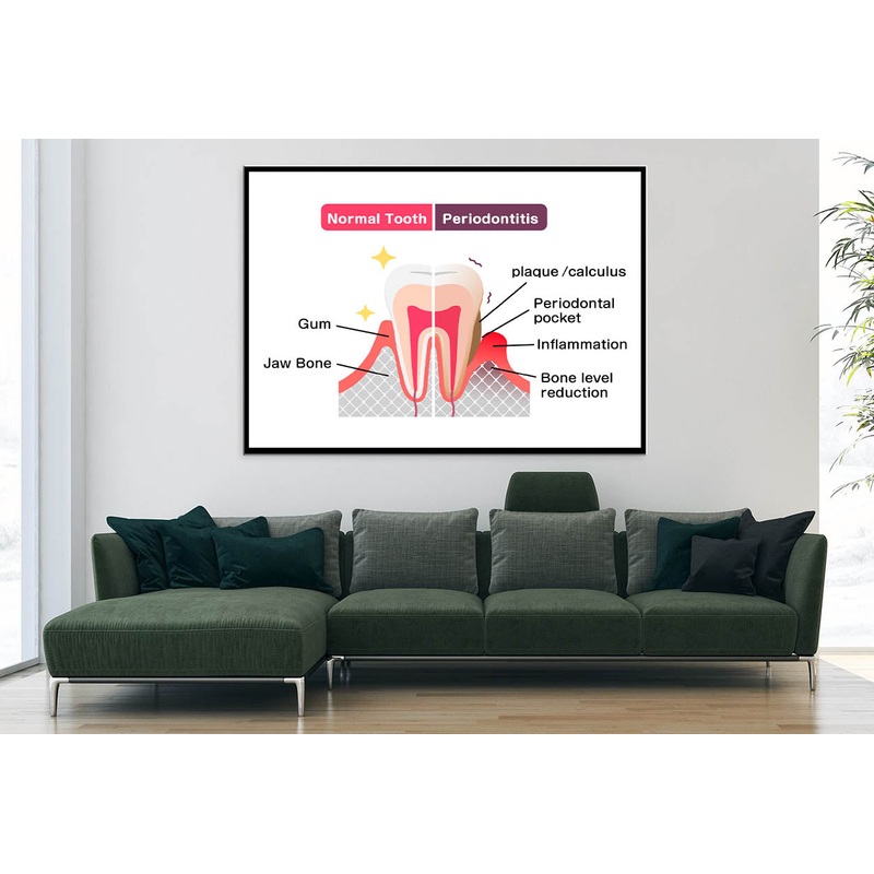 Normal Teeth & Periodontal Disease Home Decor Premium Quality Poster Print Choose Your Sizes