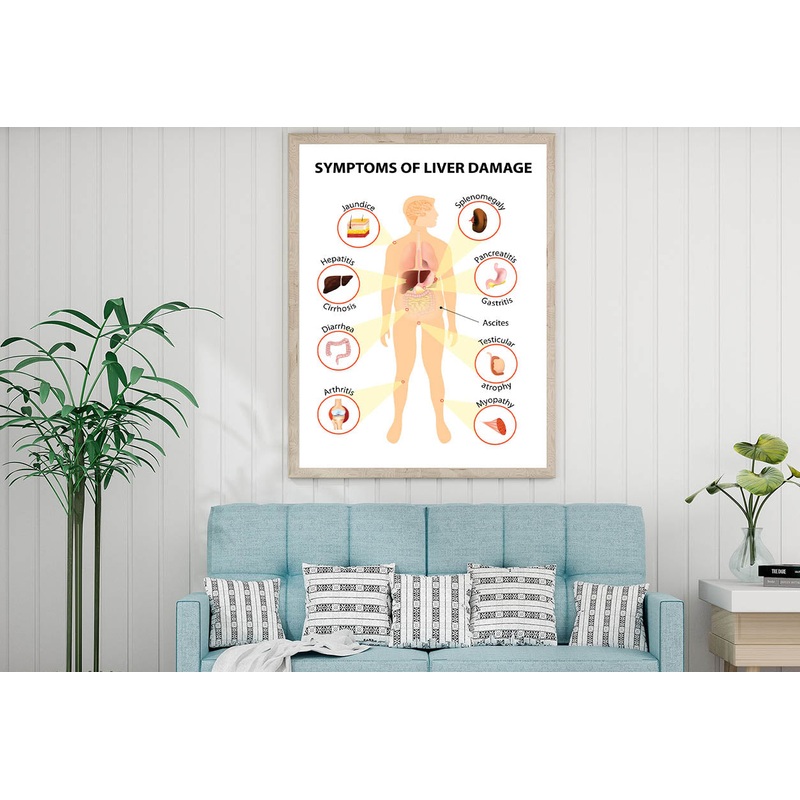 Symptoms Of Liver Disease Home Decor Premium Quality Poster Print Choose Your Sizes